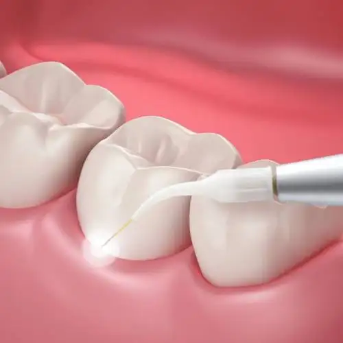 درمان بی حسی موقت با لیزر