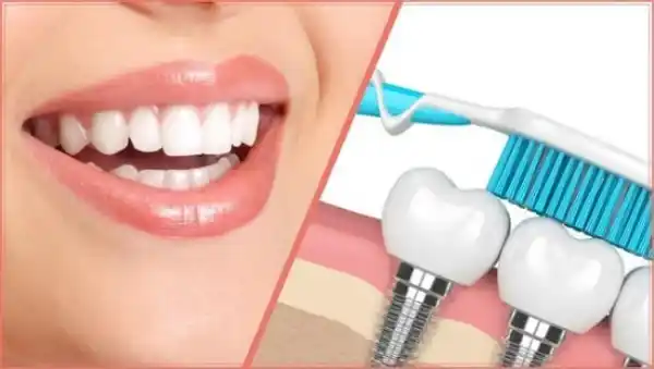 Post-implant care