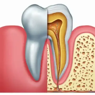 When is root canal treatment necessary to save-tooth